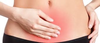 VIDEOLAPAROSCOPIA NA ENDOMETRIOSE