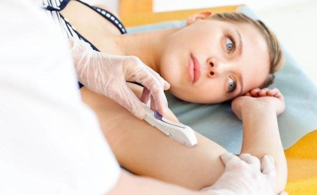 Implantes Anticoncepcionais: tudo o que você precisa saber