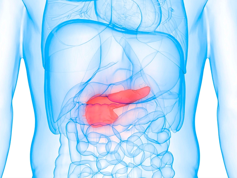 PANCREATITE