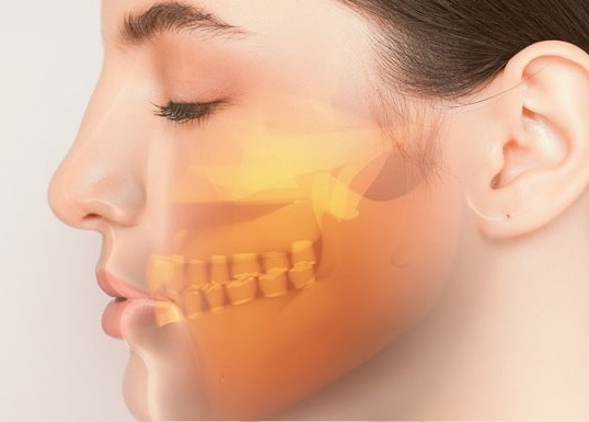 5 MOTIVOS PARA VOCÊ INDICAR OU REALIZAR A CIRURGIA ORTOGNÁTICA