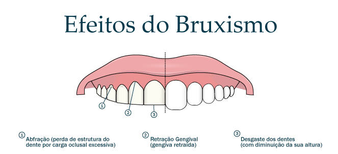 VOCÊ SABIA QUE NOSSOS DENTES ENVELHECEM?
