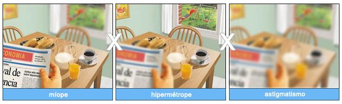 Capa do artigo MIOPIA, HIPERMETROPIA E ASTIGMATISMO: COMO CORRIGIR CIRURGICAMENTE