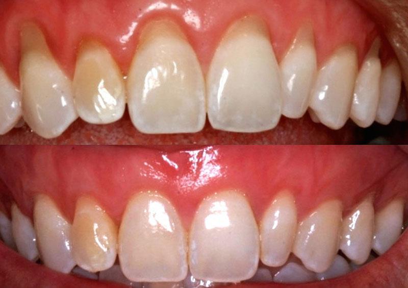 Capa do artigo PLÁSTICA GENGIVAL: PROCEDIMENTO RESPONSÁVEL PELO SORRISO MAIS BONITO E SAUDÁVEL