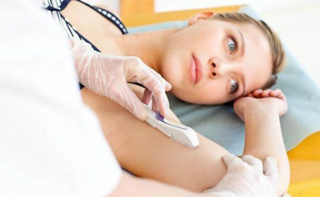 Implantes Anticoncepcionais: tudo o que você precisa saber