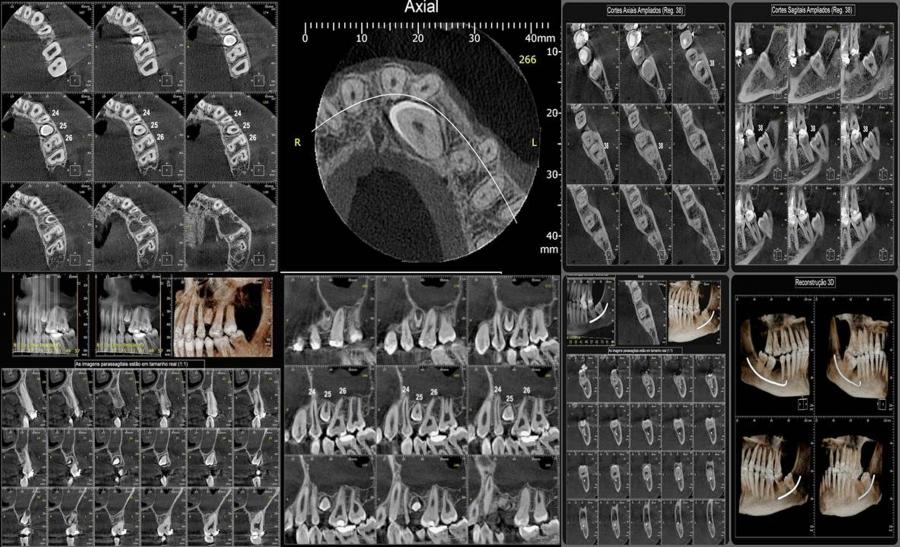 APLICAÇÕES DA RADIOLOGIA ODONTOLÓGICA