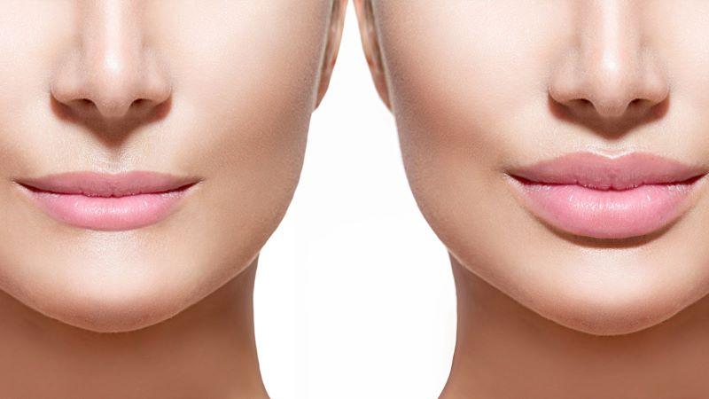 Capa do artigo HARMONIZAÇÃO OROFACIAL: A NOVA FACE DA ODONTOLOGIA MODERNA!