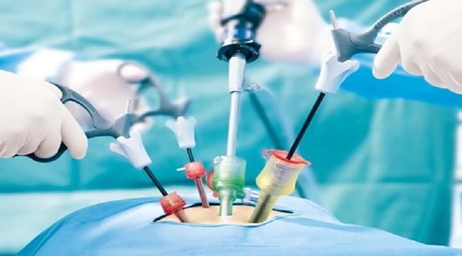 Capa do artigo O QUE VOCÊ PRECISA SABER SOBRE VIDEOCIRURGIA NA GINECOLOGIA