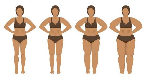 Lipedema: Desvendando a doença silenciosa que afeta milhares de mulheres