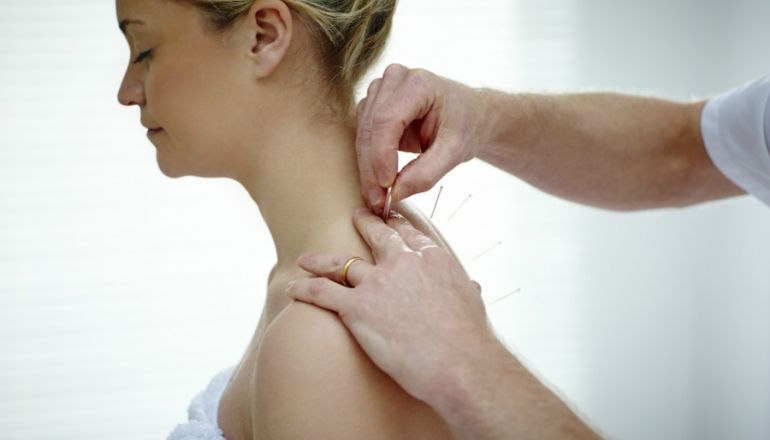 Acupuntura: uma terapia eficaz para as dores crônicas A acupuntura é uma terapia milenar originária da China, que consiste na aplicação de agulhas em pontos específicos do corpo para tratar doenças e para promover saúde. 